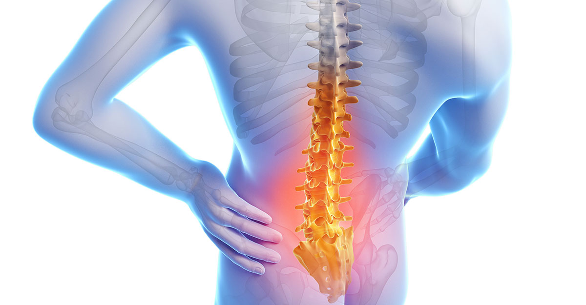 South Buffalo back pain treatment by Dr. Nowak