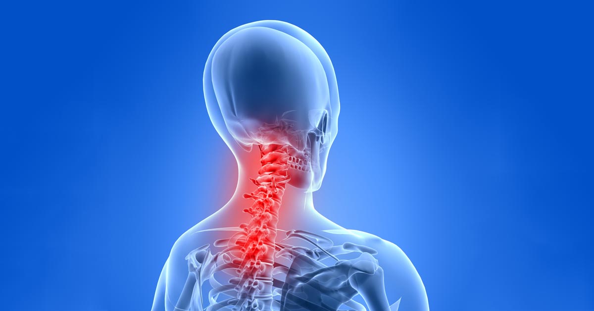 South Buffalo car accident and neck pain treatment