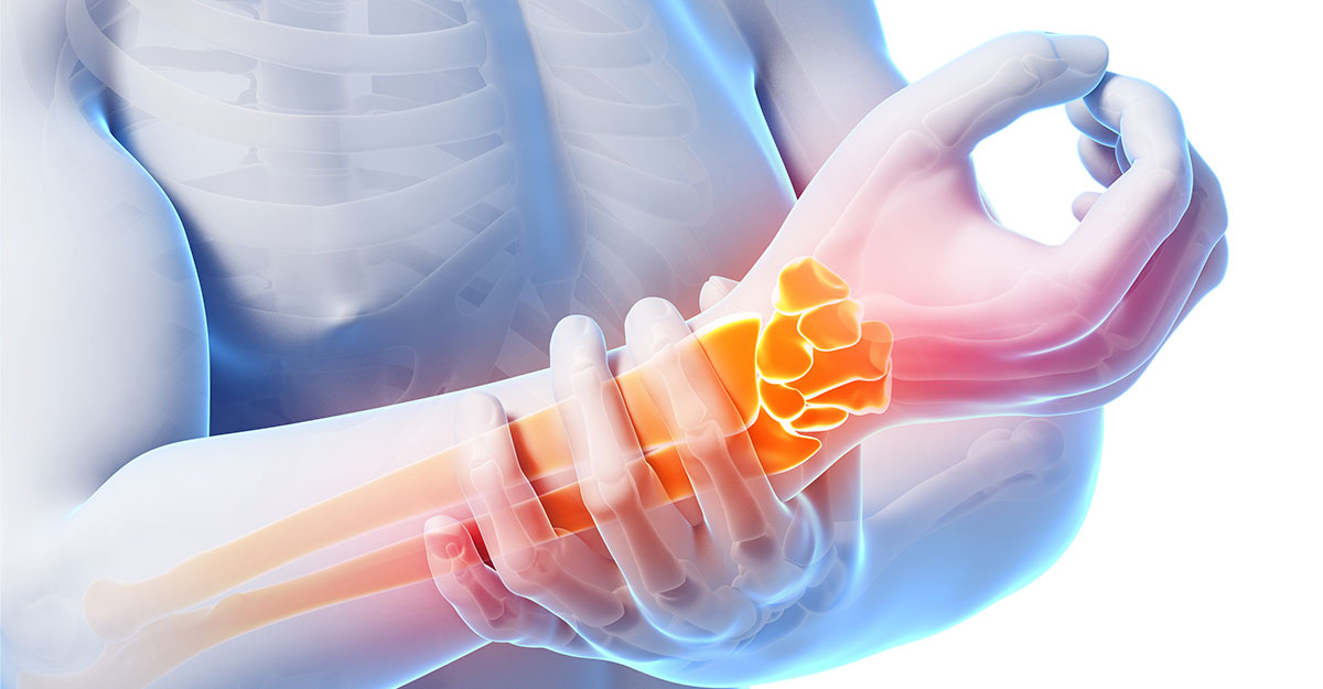 South Buffalo natural carpal tunnel treatment